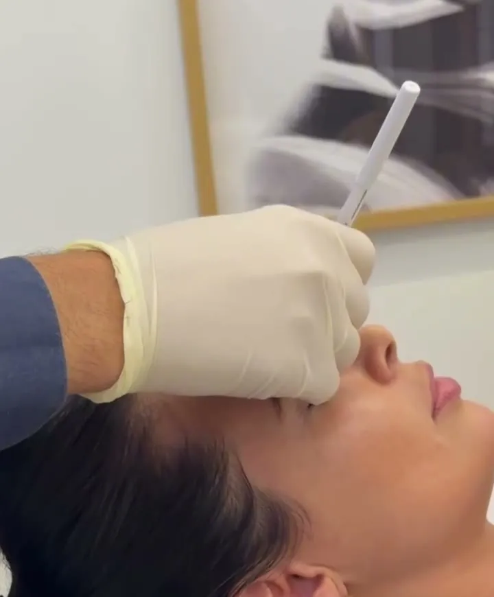 Procedimento de harmonização facial em andamento